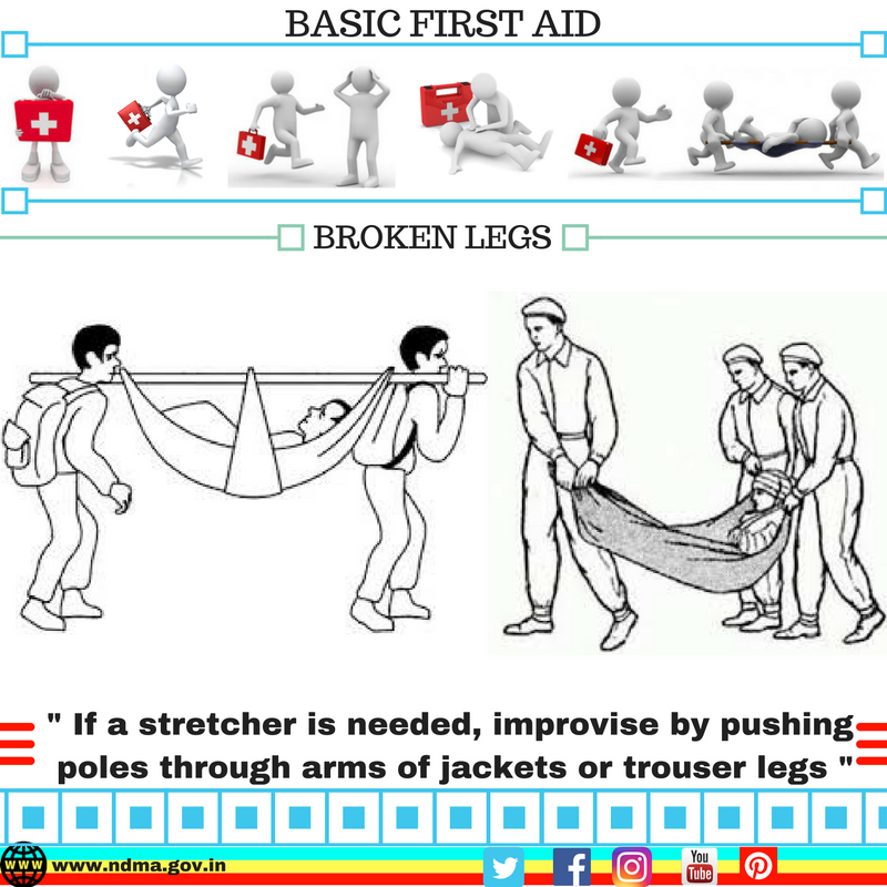 If a stretcher is needed, improvise by pushing poles through arms of jackets or trouser legs